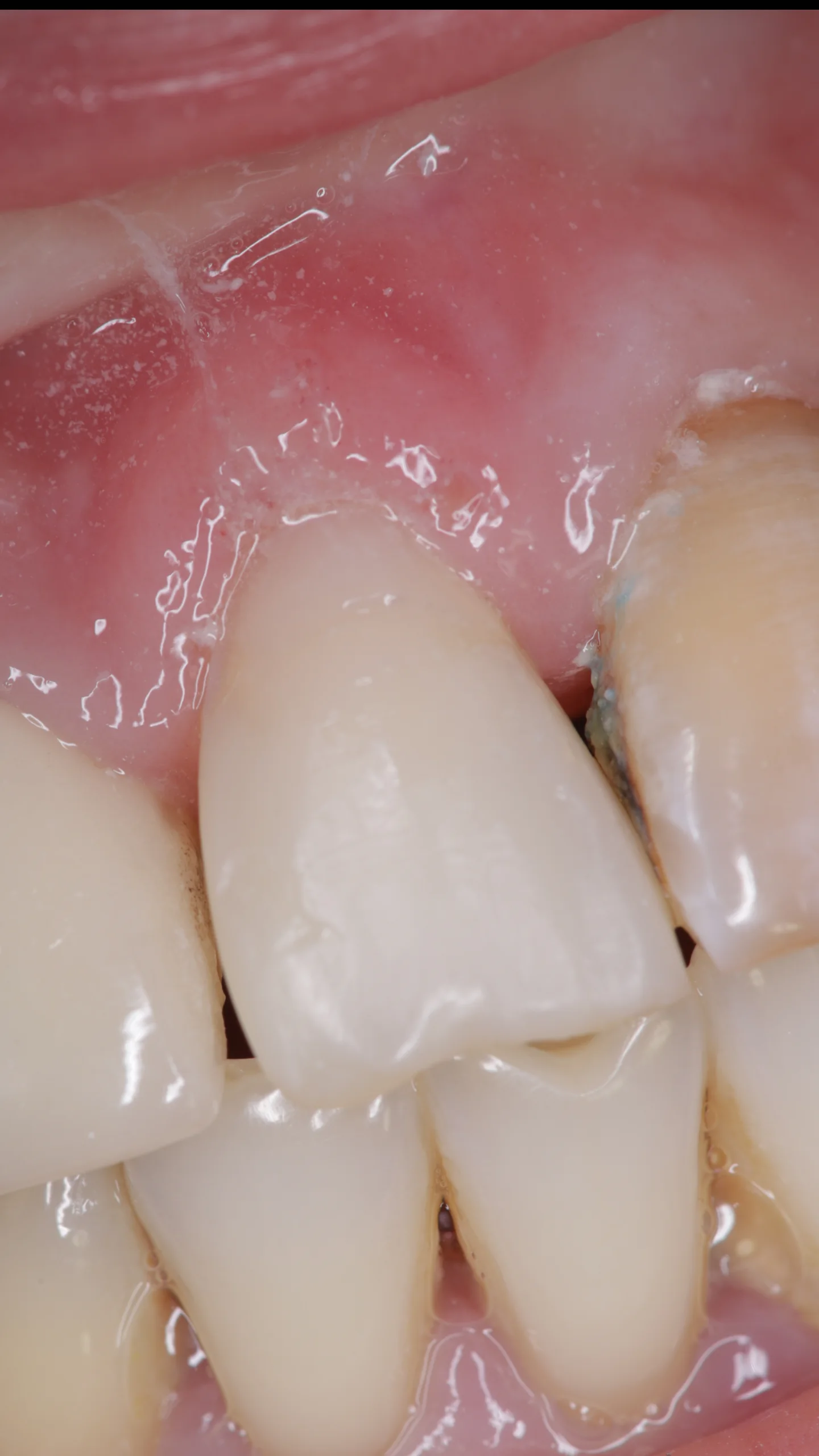 Детская стоматология