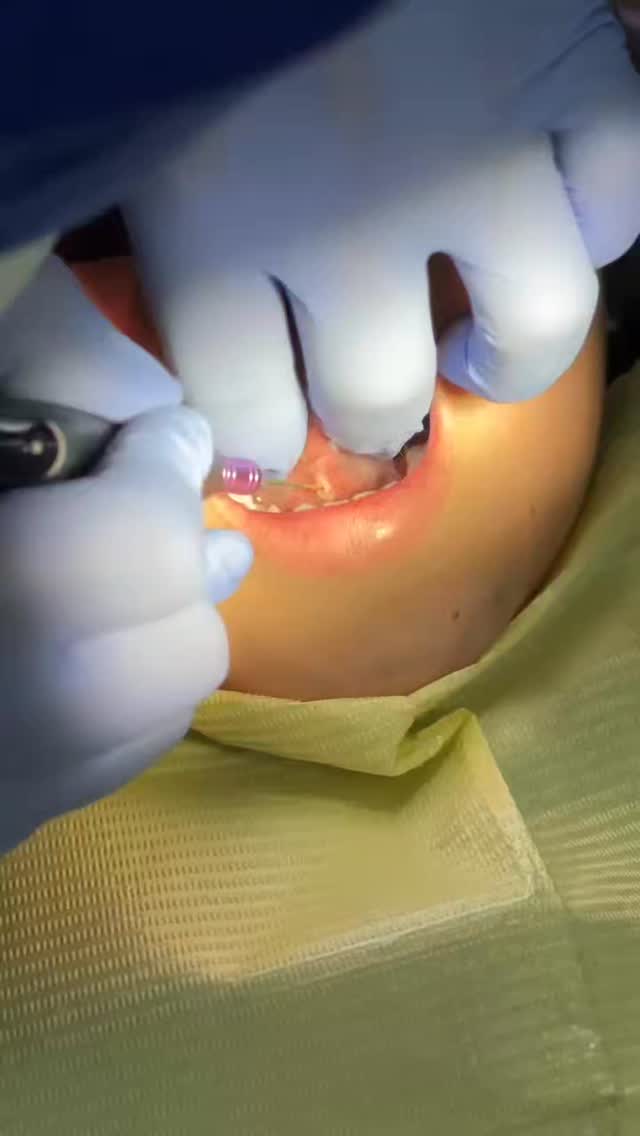 Лазерное оборудование